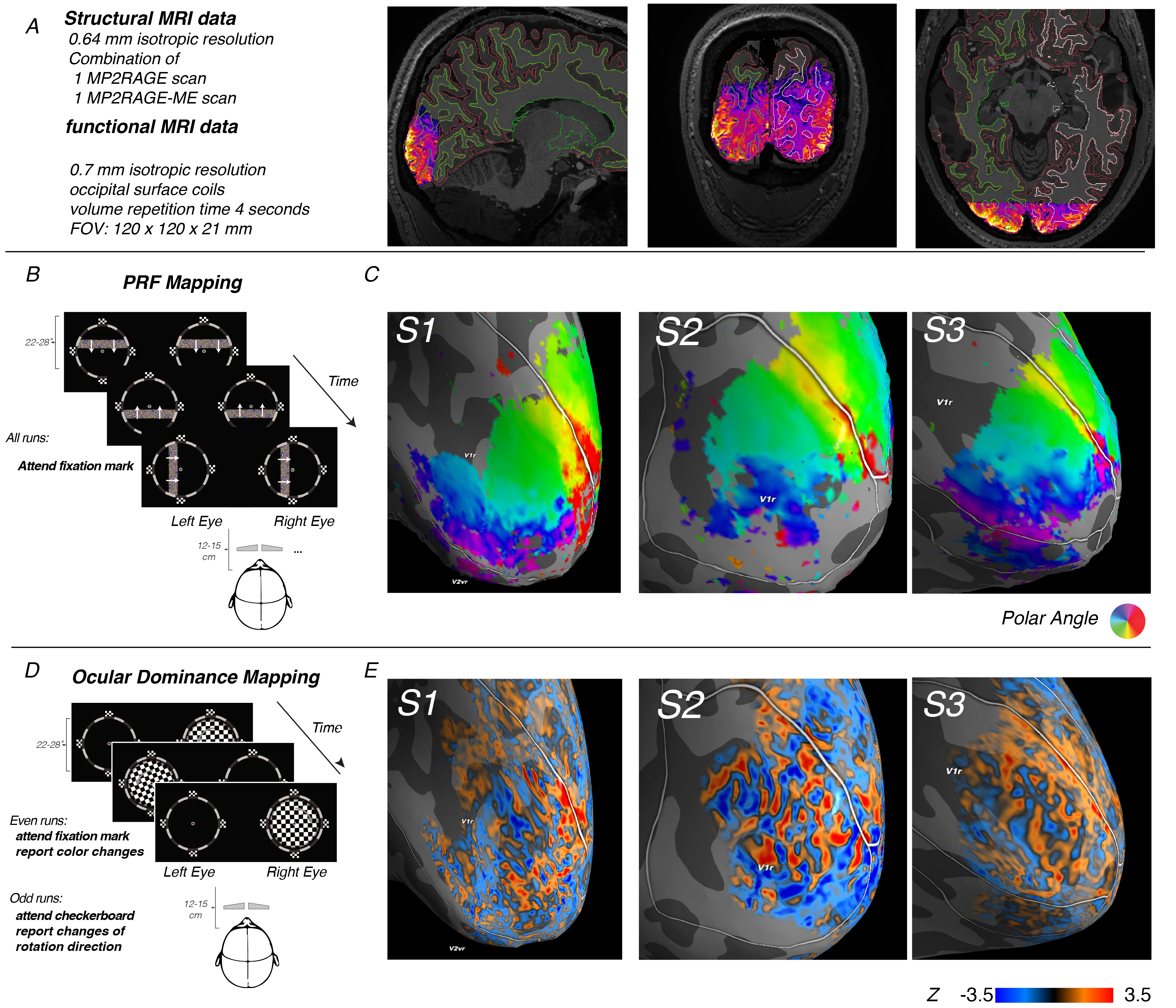 
In this experiment, we mapped out the sensitivity of neurons in primary
visual cortex (V1) to different parts of the visual field, as well as
different eye using fMRI.
<strong>(A)</strong> our field of view only included the occipital pole
and thereby the foveal parts of V1. The data was carefully registered
to a 0.64mm T1-weighted anatomical image.
<strong>(B)</strong> We performed a standard PRF mapping paradigm and
PRF model to quantify to which parts of the visual field different
patches of V1 were most sensitive. This allowed us to relate
columnar patterns to retinotopy, as well as define the border between V1
and V2 by the charachteristic phase reversals in retinotopy.
<strong>(C)</strong> By presenting flickering checkerboards seperately
to the two eyes, contained by a salient frame that helped eye convergence,
we could map out ocular dominance columns: little ~1mm-wide stripes of
corte that are particularly sensitive to the left or right eye.
